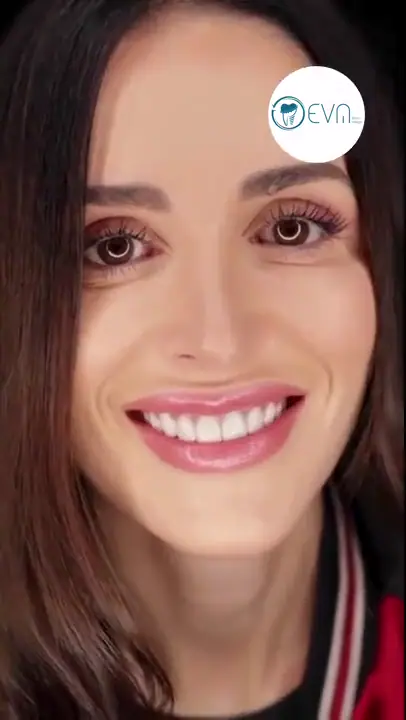 Abagail Relooking du sourire in Turkey video cover