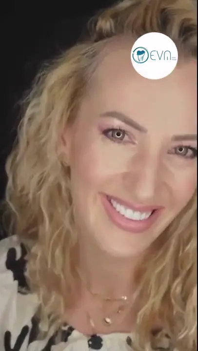 Hollywood Smile d’Adrianna en Turquie video cover