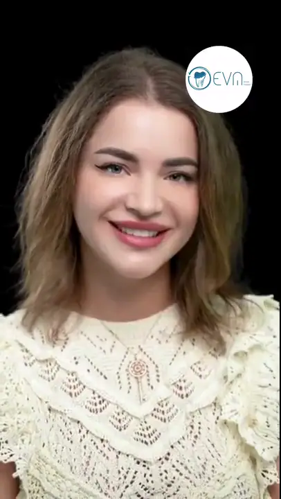 Adrianna Facettes en porcelaine in Turkey Before and After video cover