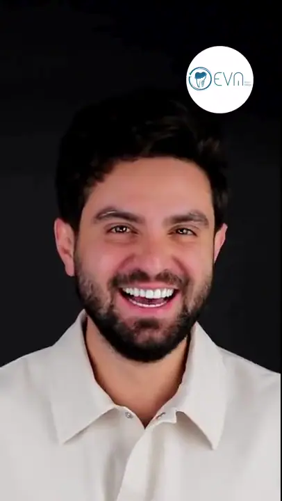 Agustin Transformation du sourire in Turkey video cover