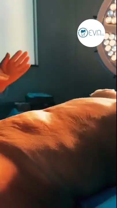 Abdominoplastie d’Alina en Turquie avant et après video cover
