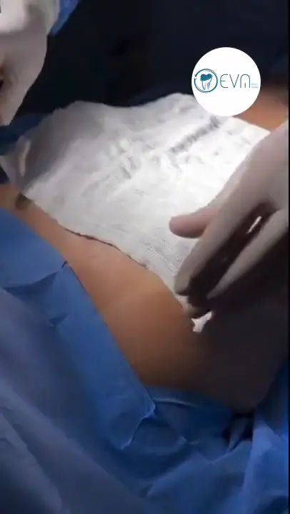 Amaya Augmentation mammaire in Turkey Before and After video cover