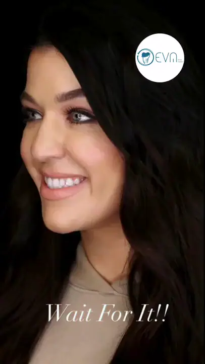 Amina Relooking du sourire in Turkey Before and After video cover
